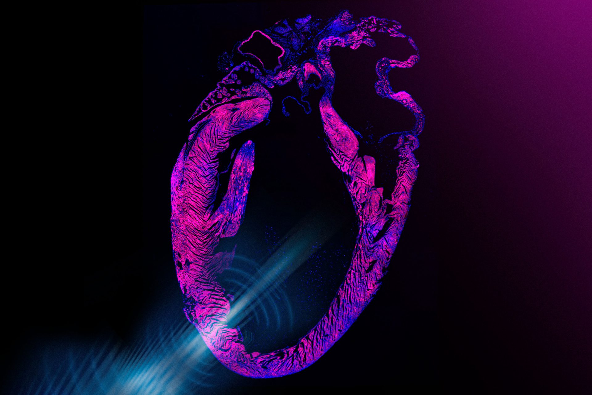Ultrasound-based pacemaker noninvasively steadies the heart